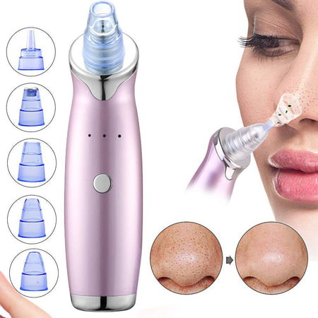 💎 Aspirateur de Points Noirs Premium 💎